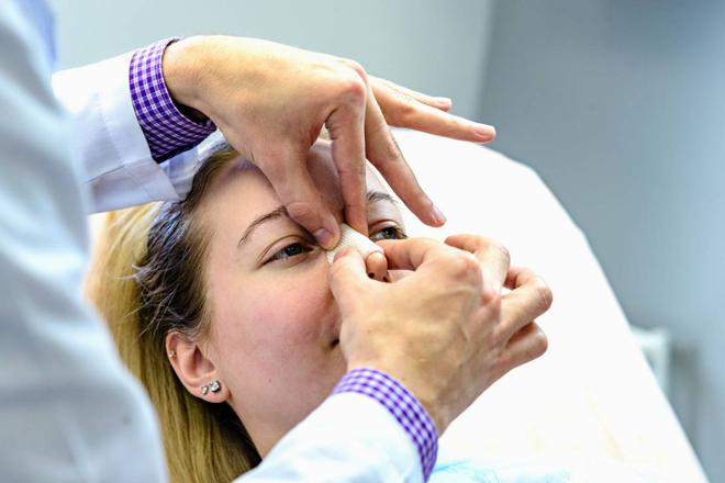 Rhinoplastie : que faire après une fracture du nez ?