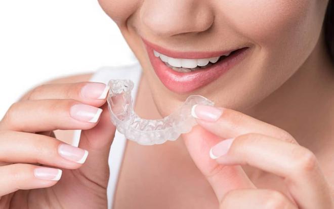 Traitement orthodontique : un procédé qui séduit de plus en plus d’adultes