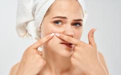 SOS peau acnéique ! Tout savoir sur le zinc – l’anti-inflammatoire miracle à essayer à tout prix