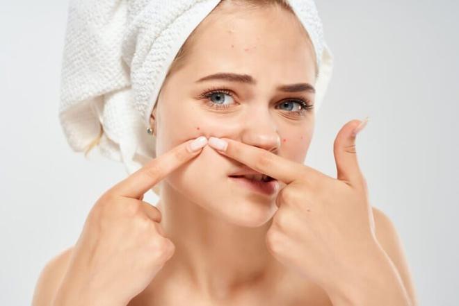 SOS peau acnéique ! Tout savoir sur le zinc – l’anti-inflammatoire miracle à essayer à tout prix