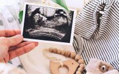 6 accessoires écologiques pour bébé et maman