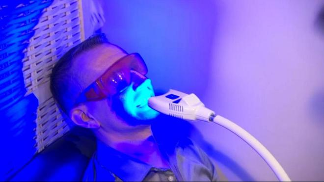 ENQUÊTE - Blanchiment des dents à bas coût : quels résultats ? Quels risques ?