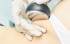 Tout savoir sur la lipocavitation : fonctionnement, avantages et inconvénients