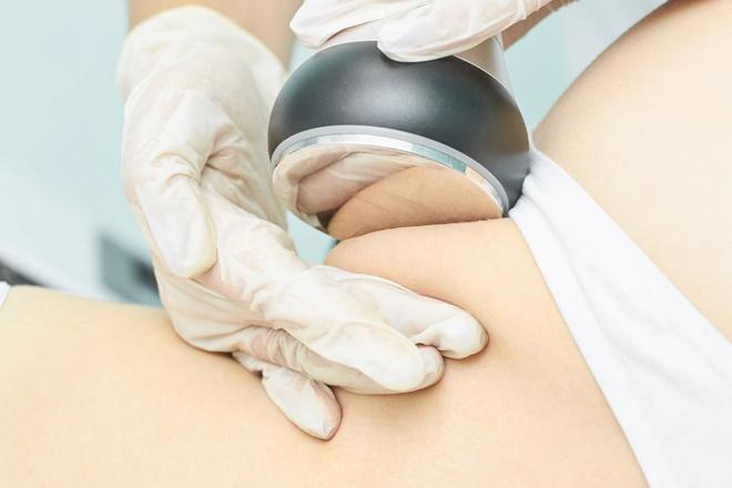 Tout savoir sur la lipocavitation : fonctionnement, avantages et inconvénients