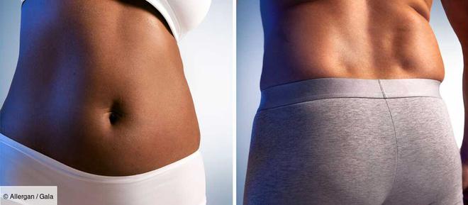 Découvrez comment se déroule une séance de cryolipolyse CoolSculpting®